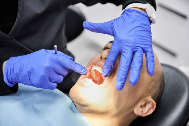 Best Broken or Chipped Tooth Repair in Ruleville, MS